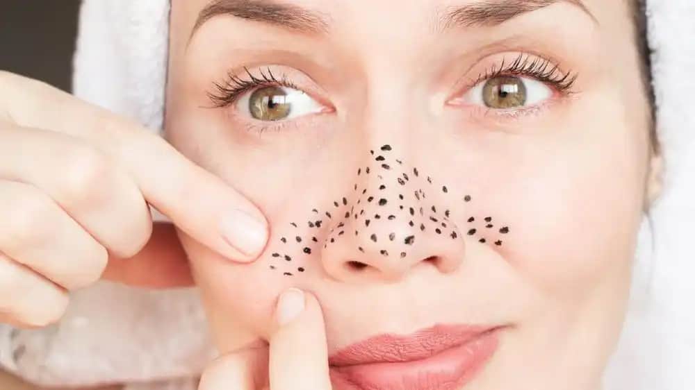 Sırtınızdaki Siyah Noktaları Temizlemenin En Etkili Yolları ve Önleyici İpuçları