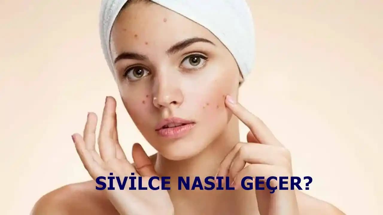 Sivilce Ağrısına İyi Gelen Yöntemler ve Doğru Cilt Bakımı İpuçları
