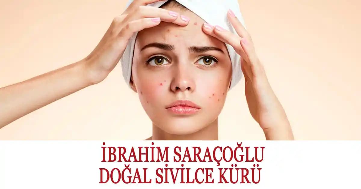 Sivilce Kürü ve Cilt Sağlığı İçin Bilmeniz Gerekenler