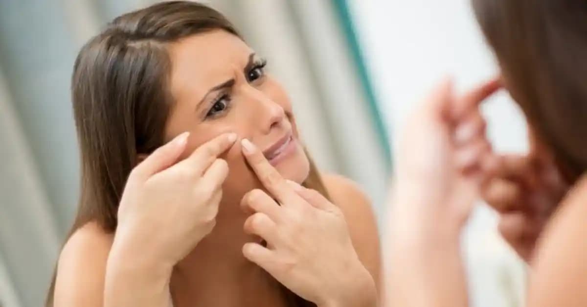 Sivilce Oluşumunu Engelleyen Besinler ve Sağlıklı Cilt İçin Beslenme Önerileri