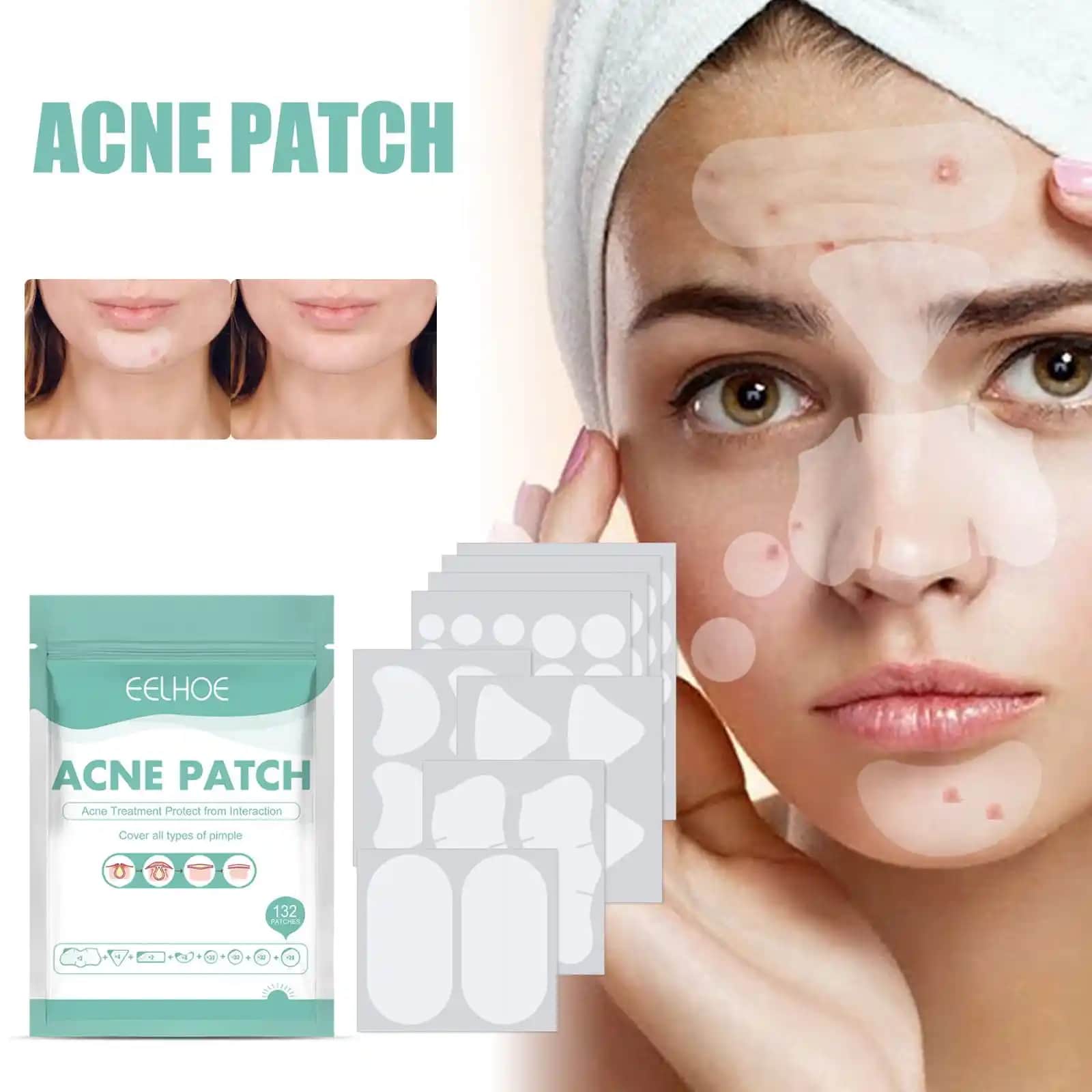 Sivilce Tedavisinde Etkili Çözüm: Pimple Patch'ler ve Kullanım İpuçları