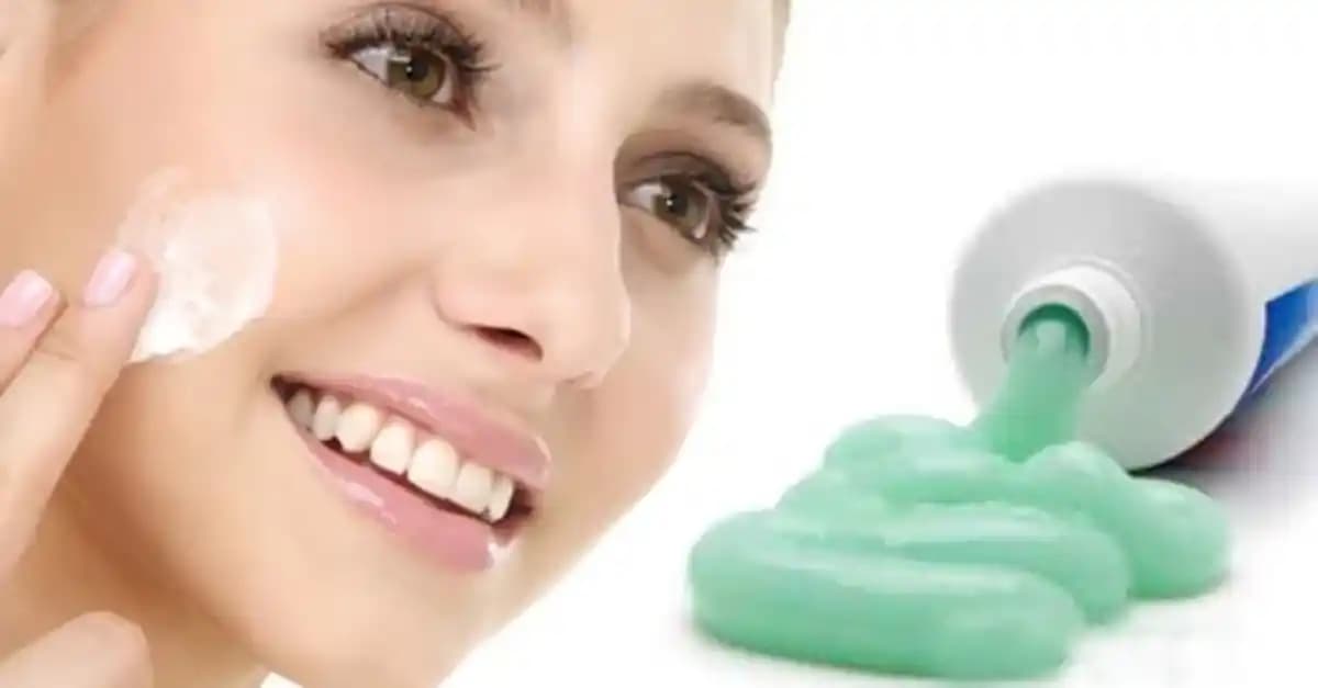 Sivilceler İçin Diş Macunu Kullanımı: Gerçekler ve Yanılgılar Üzerine Bilimsel Değerlendirme