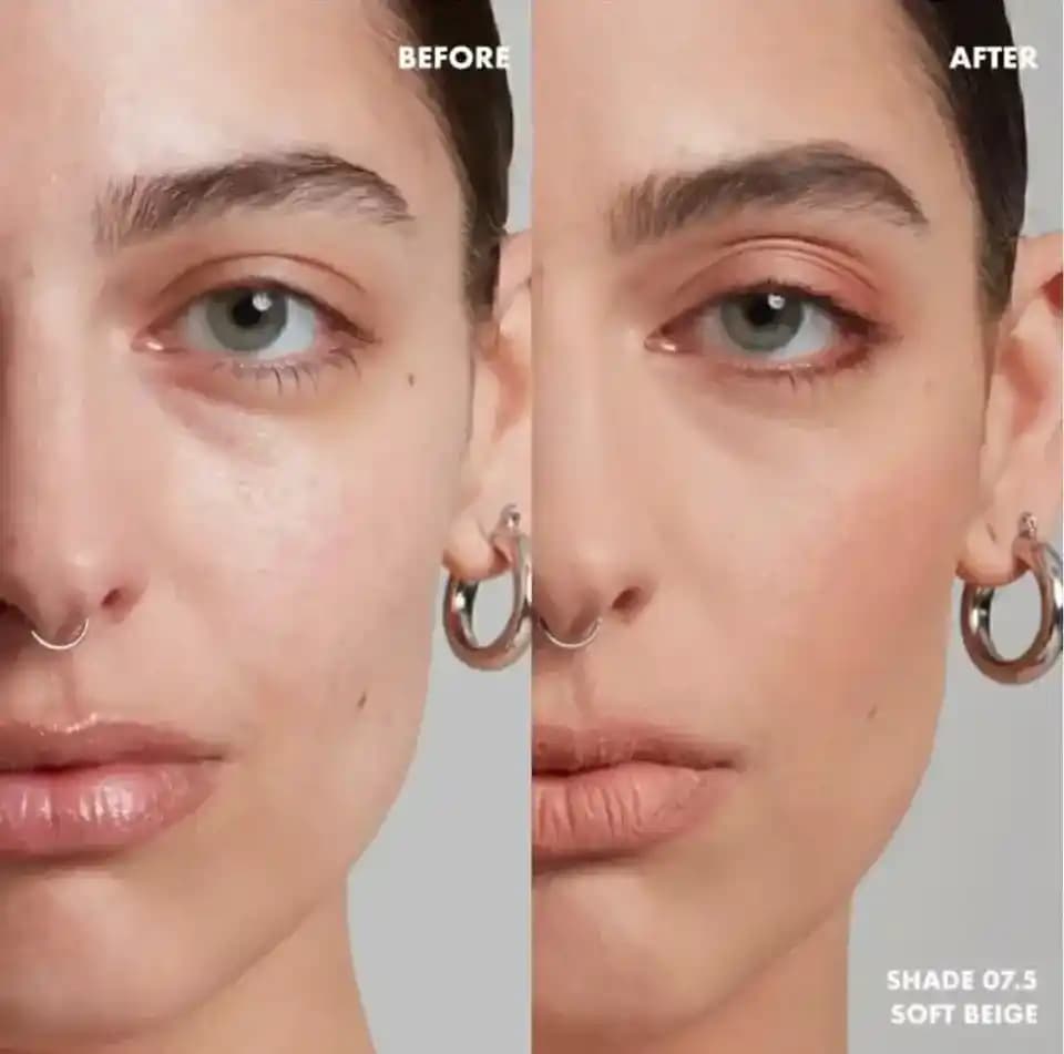 Sivilceli Ciltler İçin Fondöten Seçimi ve Doğru Uygulama Yöntemleri