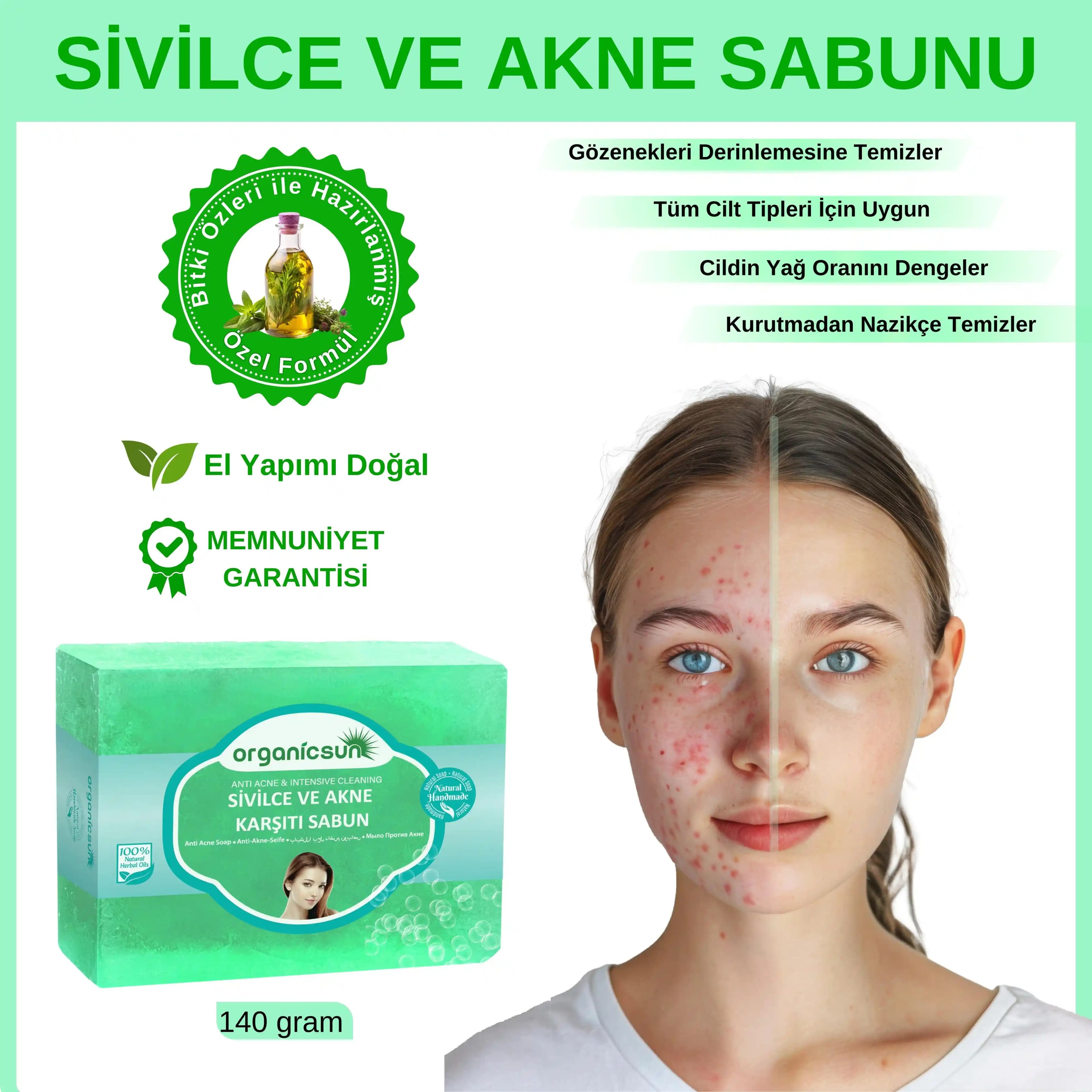 Sivilceye Karşı Etkili Sabun Seçenekleri ve Doğru Kullanım Yöntemleri Rehberi