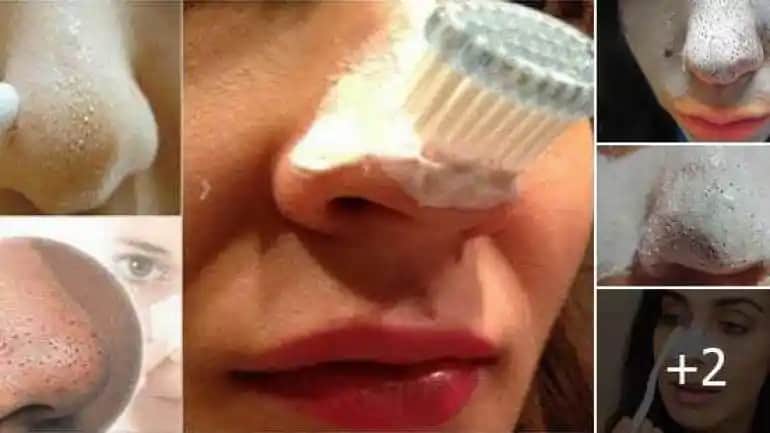 Siyah Nokta Temizliği ve Koruyucu Diş Macunu Seçenekleri Hakkında Kapsamlı Rehber