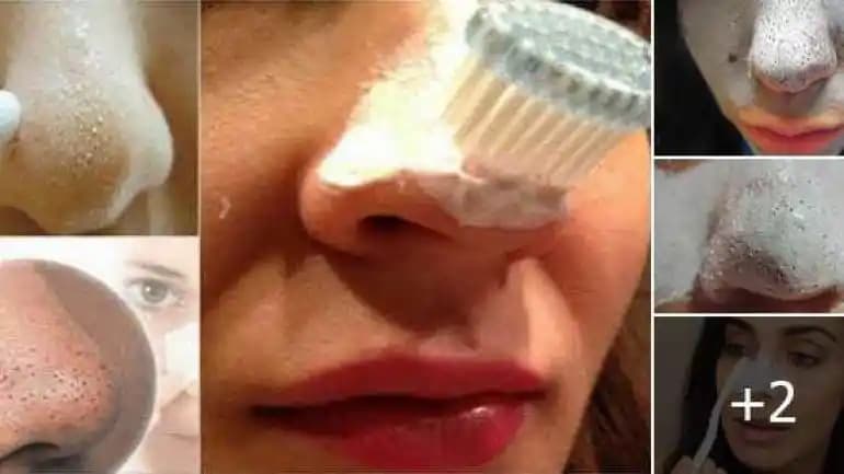 Siyah Nokta Temizliği ve Koruyucu Diş Macunu Seçenekleri Hakkında Kapsamlı Rehber