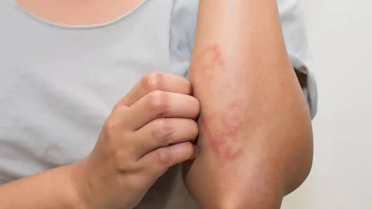 Vücut Kararmalarının Nedenleri ve Etkili Çözüm Yolları Hakkında Detaylı Bilgi