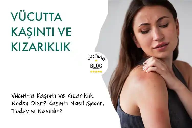 Vücutta Ani Kızarıklık ve Kozmetik Ürünlerle İlişkisi Hakkında Bilmeniz Gerekenler