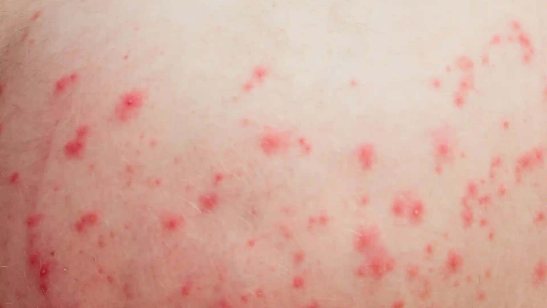 Vücutta Kırmızı Noktaların Nedenleri ve Kozmetik Yaklaşımlarını Anlama Rehberi