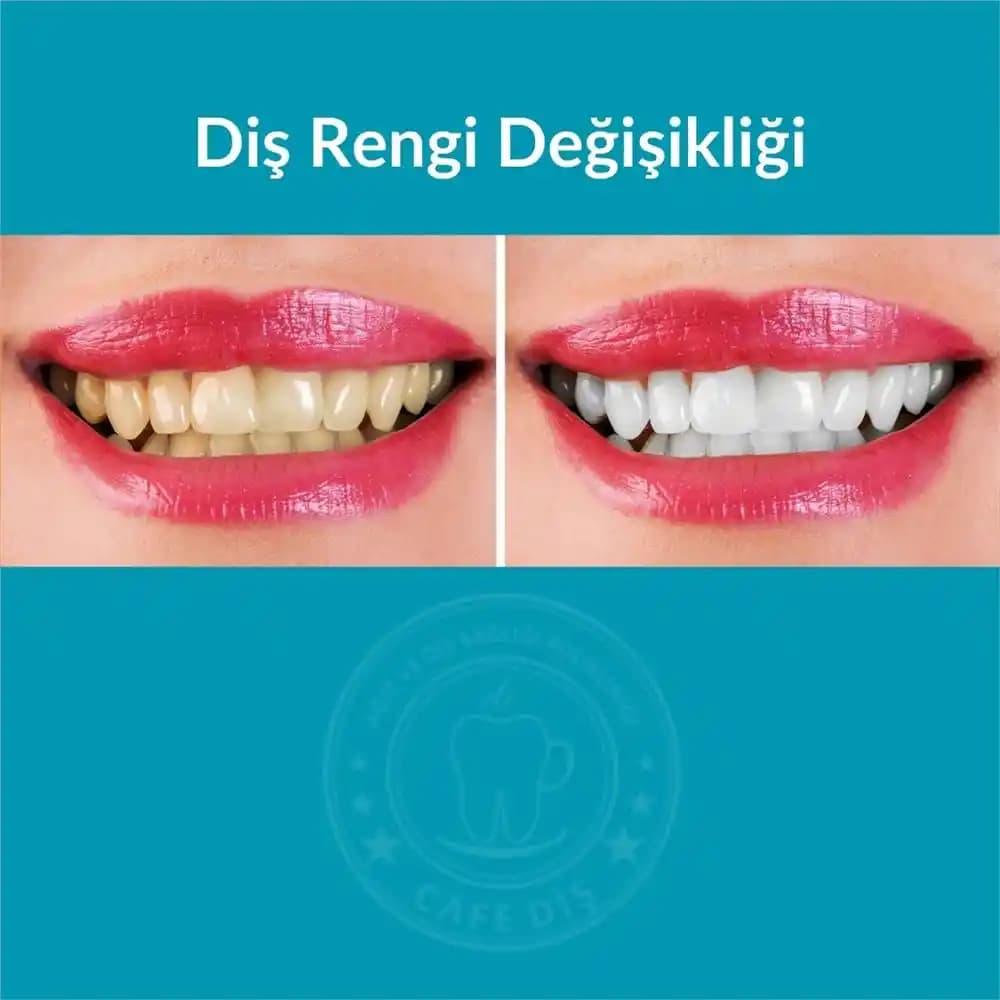 Vücutta Renk Değişikliği Nedenleri ve Etkili Çözüm Yöntemleri Hakkında Bilmeniz Gerekenler