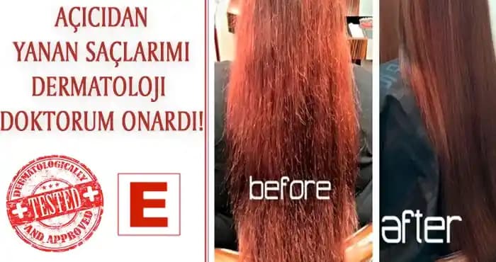 Yanmış ve Dökülen Saçlara Yönelik Saç Sağlığı Koruma ve Yenileme Rehberi