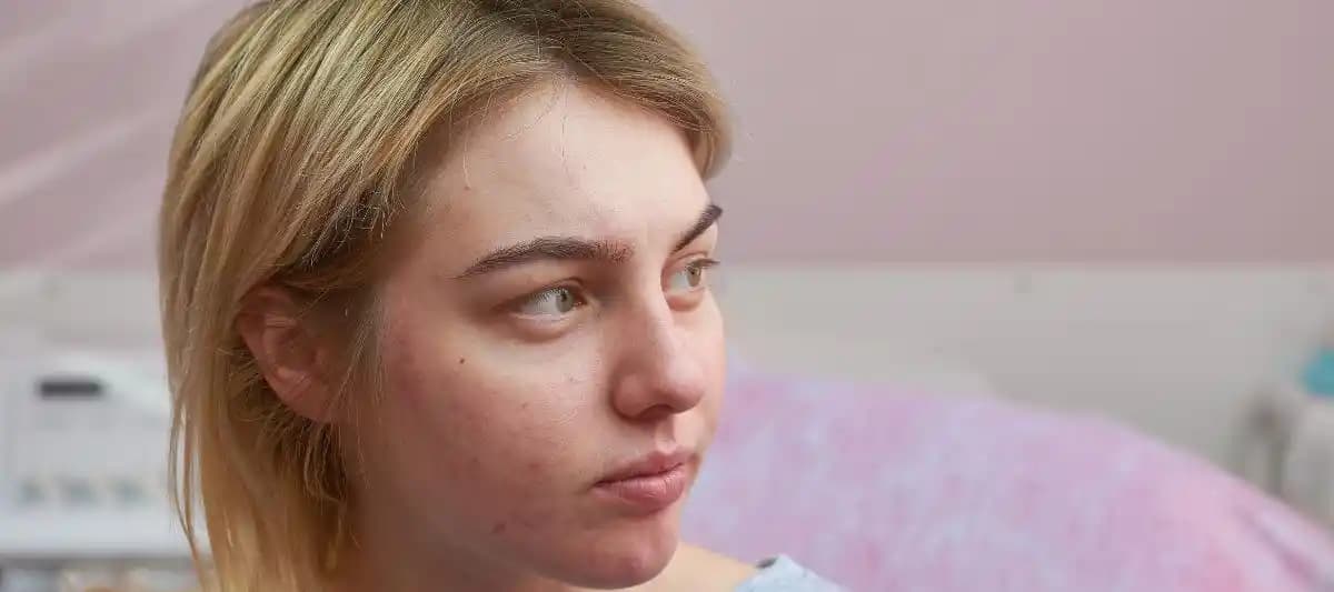 Yıllar<dı>r Geçmeyen Sivilcelerle Mücadele Yöntemleri ve Cilt Bakımında Dikkat Edilmesi Gerekenler