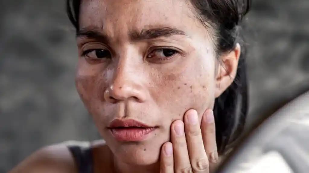 Yüz Kararmasının Nedenleri ve Etkili Korunma Yöntemleri Analizi