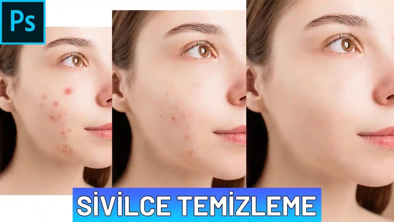 Yüz Pürüzsüzleştirme Yöntemleri ve Cilt Bakımında En Etkili Teknikler