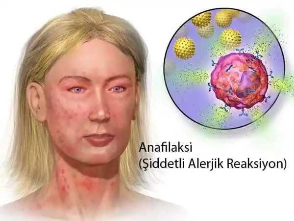 Yüzde Alerjik Reaksiyonları ve Güvenilir Kozmetik Ürün Seçimi Rehberi