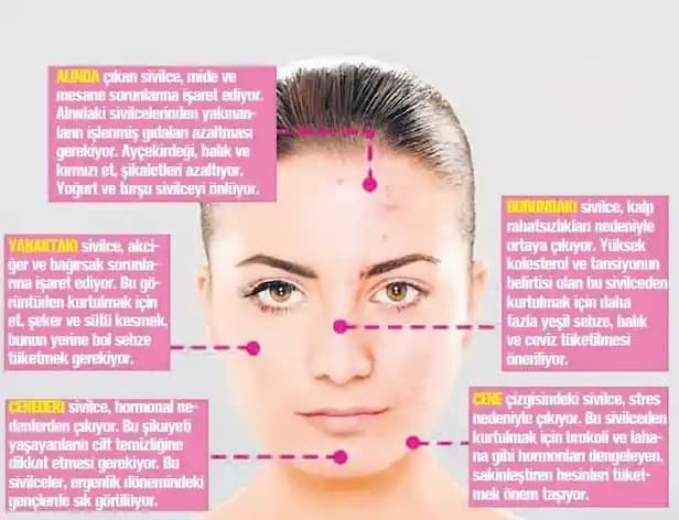 Yüzde Çıkan Sivilceler: Nedenleri ve Etkili Çözüm Yöntemleri