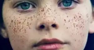 Yüzde Çil Nedenleri ve Gelişimini Etkileyen Faktörler Hakkında Detaylı Bilgi