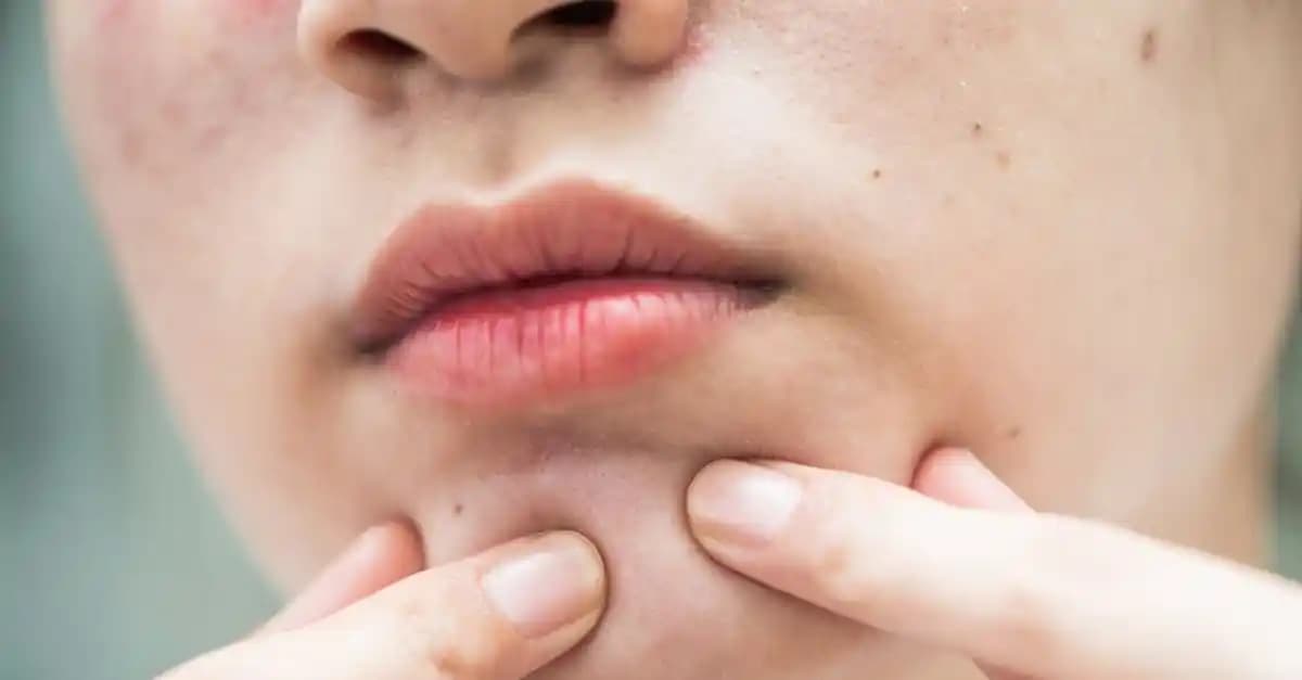 Yüzde Tırnak Yaralarına Karşı Doğru Bakım ve Tedavi Yöntemleri