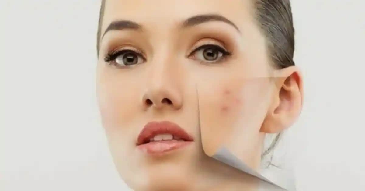 Yüzde Yara ve Çatlakların Nedenleri, Belirtileri ve Etkili Tedavi Yöntemleri