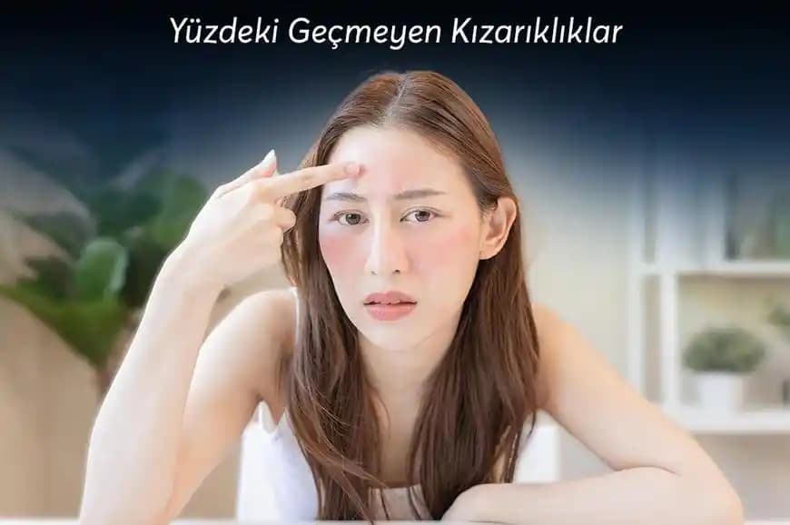 Yüzde Yuvarlak Kızarıklıkların Nedenleri ve Etkili Çözüm Yöntemleri