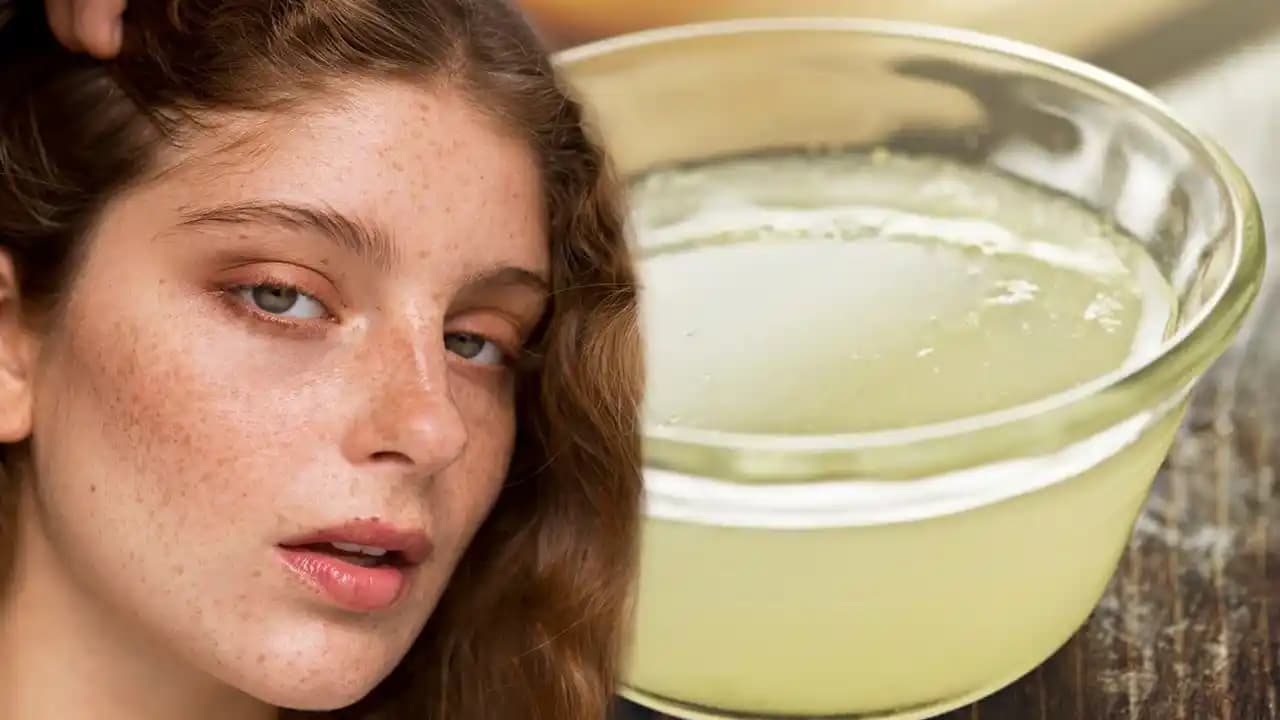 Yüzdeki Cilt Parlaklığını Kaybetme ve Çillerin Giderilmesi Yöntemleri