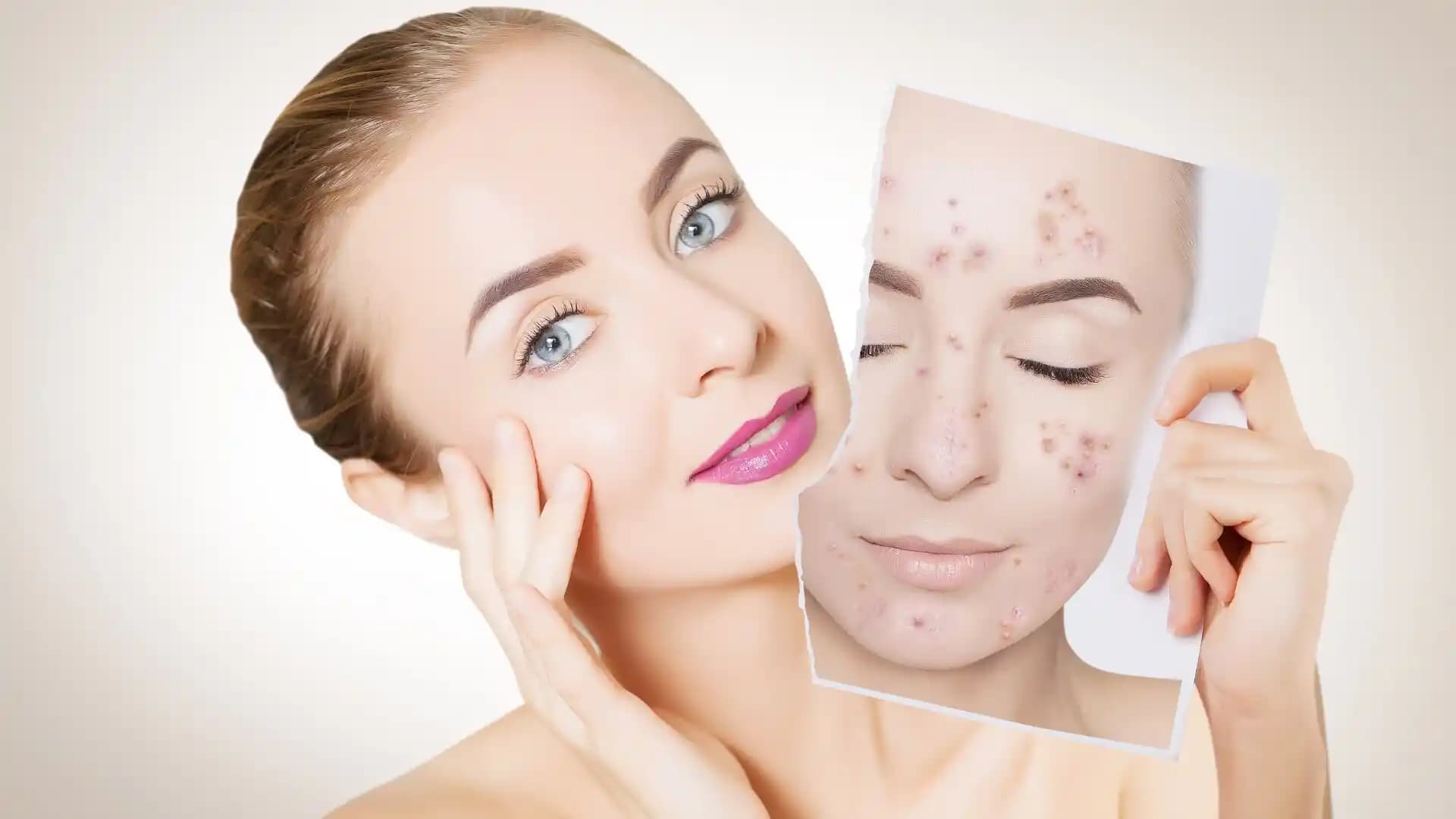 Yüzdeki Komedonların Nedenleri ve Etkili Temizleme Yöntemleri Hakkında Detaylı Rehber