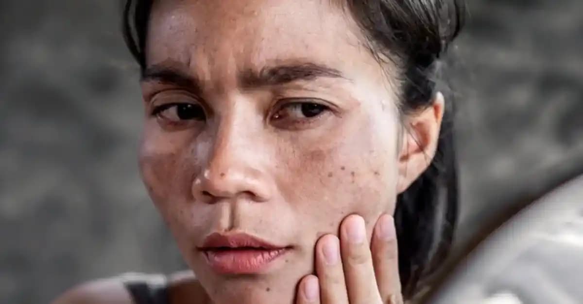 Yüzdeki Lekelerin Nedenleri ve Etkili Kozmetik ve Sağlık Çözümleri