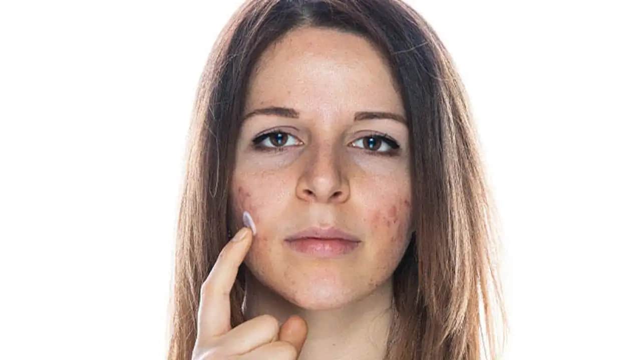 Yüzdeki Pürüzlere Karşı Doğal ve Etkili Çözüm Yöntemleri ve Bakım İpuçları