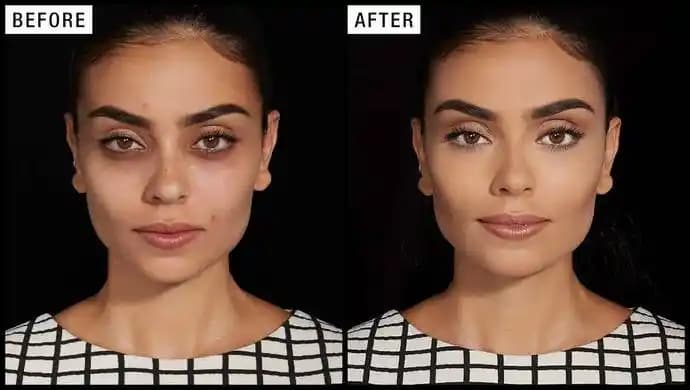 Yüzdeki Renk Eşitsizliği Nasıl Giderilir ve Daha Homojen Bir Cilt Sağlanır