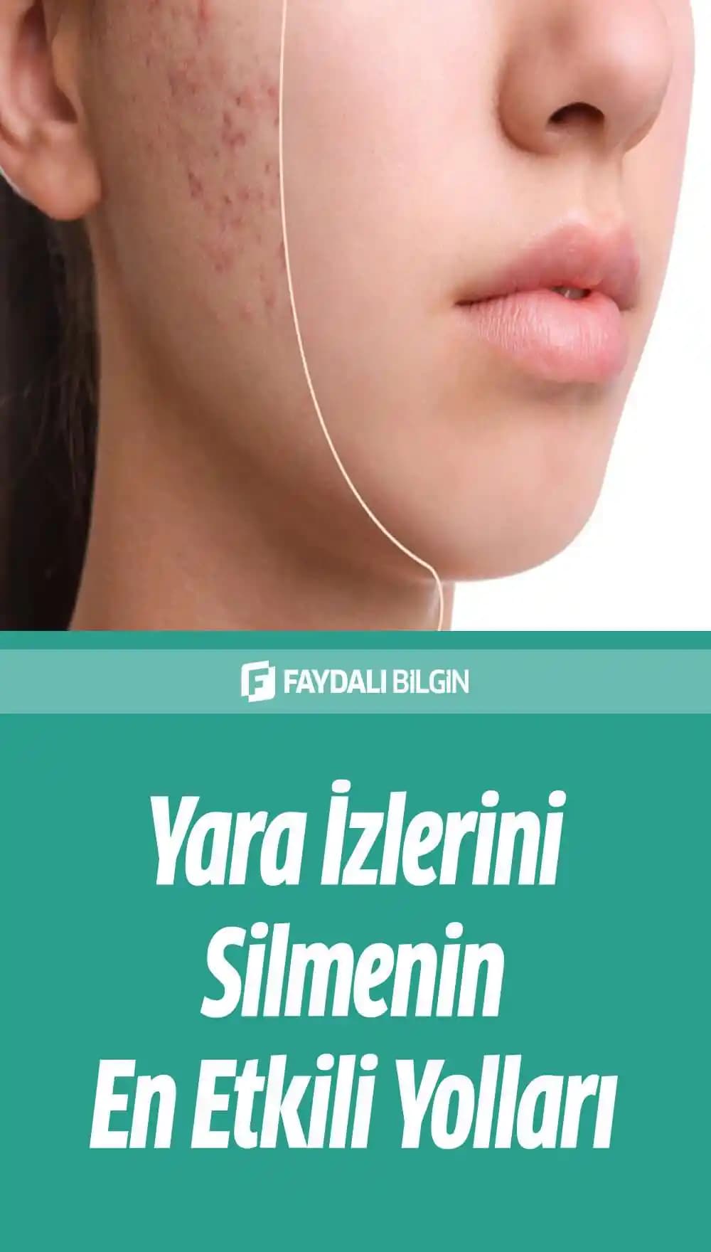 Yüzdeki Yaraların Hızlı İyileşmesi İçin Bilimsel ve Doğal Yöntemler
