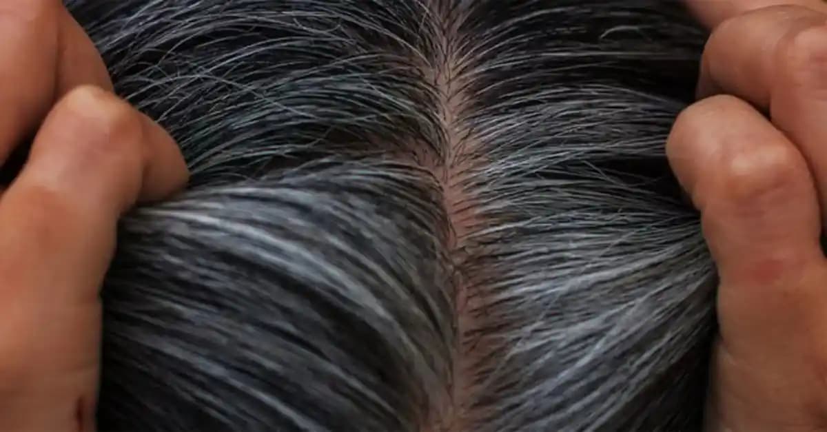 Saçtaki Beyazları Kapatma Yöntemleri: Kimyasal ve Doğal Çözümlerin Karşılaştırması