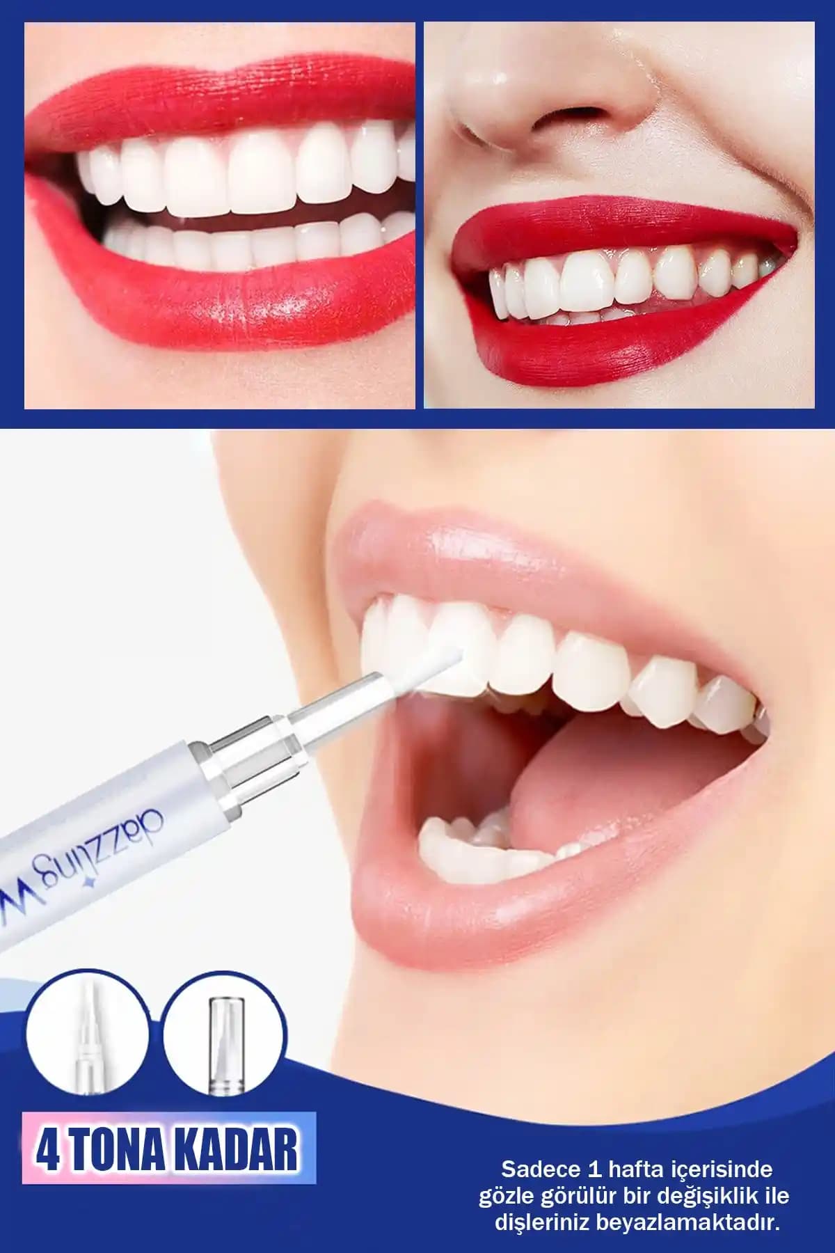 Diş Kalemi Nedir ve Nasıl Kullanılır: Estetik ve Sağlık Açısından Bilmeniz Gerekenler