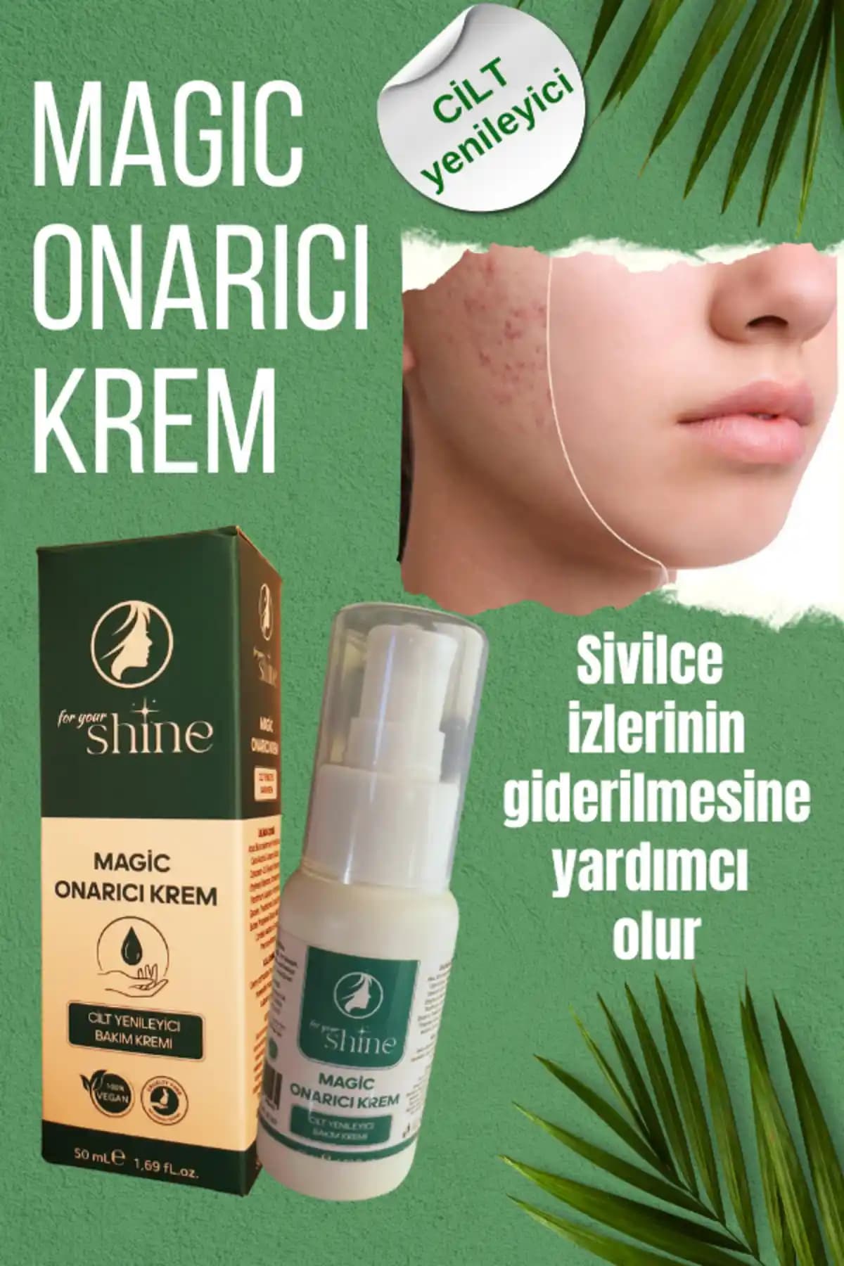 Eczaneden Temin Edilebilen Sivilce İzi Kremleri ve Kullanım İpuçları