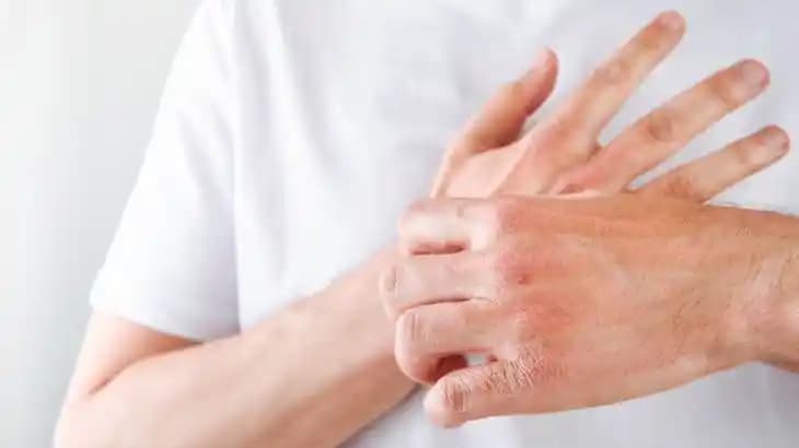 El Tahrişine Karşı Etkili Bakım Yöntemleri ve Doğal Çözümler