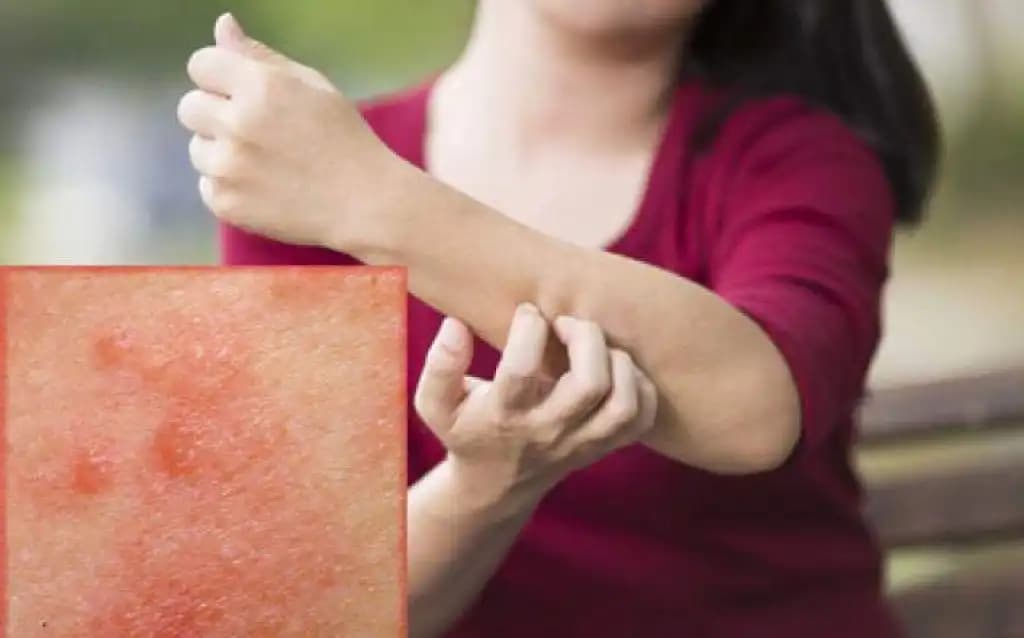 Elde Kabarmanın Nedenleri ve Etkili Çözüm Yolları Hakkında Kapsamlı Bilgi