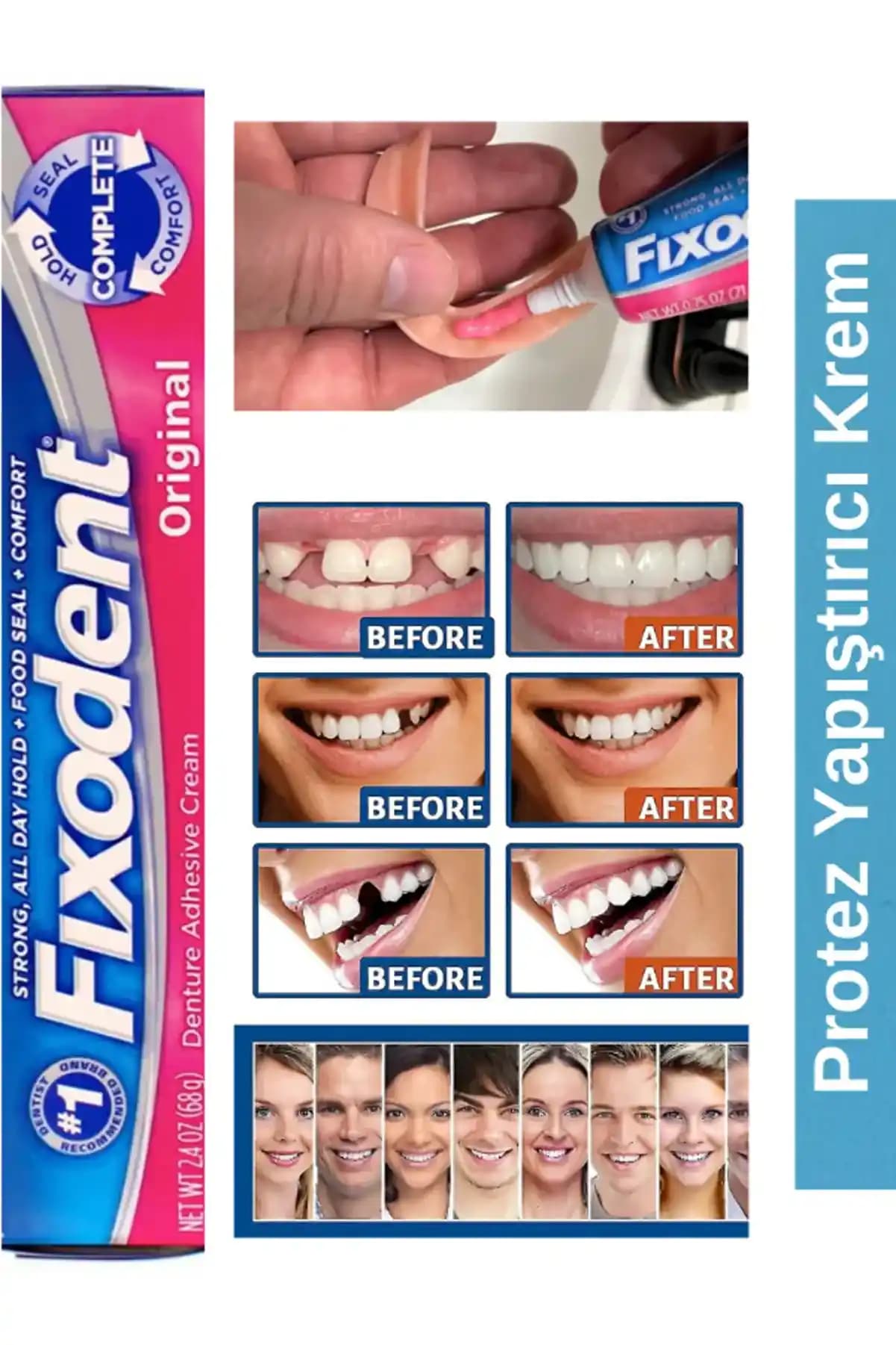Fixodent Diş Yapıştırıcısı: Protez Kullanıcıları İçin Güvenilir ve Etkili Çözüm
