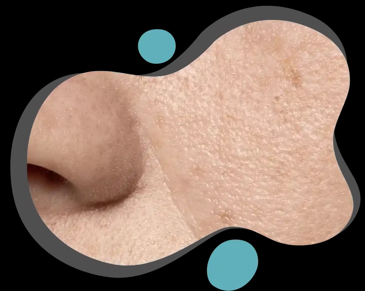 Geniş Gözenekleri Azaltma Yöntemleri ve Cilt Sağlığı İçin İpuçları