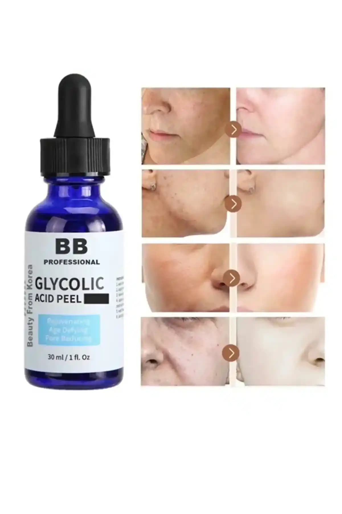 Glikolik Asit Peeling ile Cilt Yenileme ve Gençleştirme Yöntemleri