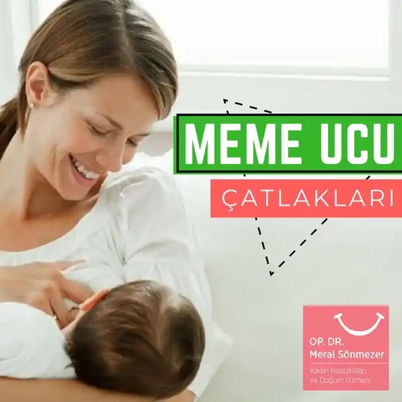 Meme Başında Çatlaklar ve Cilt Sağlığı İçin Etkili Koruma Yöntemleri
