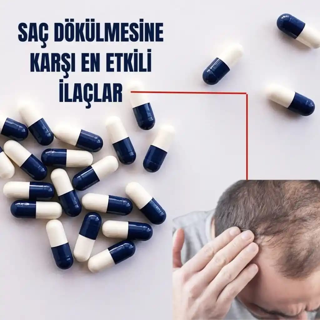 Saç Dökülmesine Karşı Etkili İlaçlar ve Güncel Yaklaşımlar Hakkında Bilgilendirici Rehber