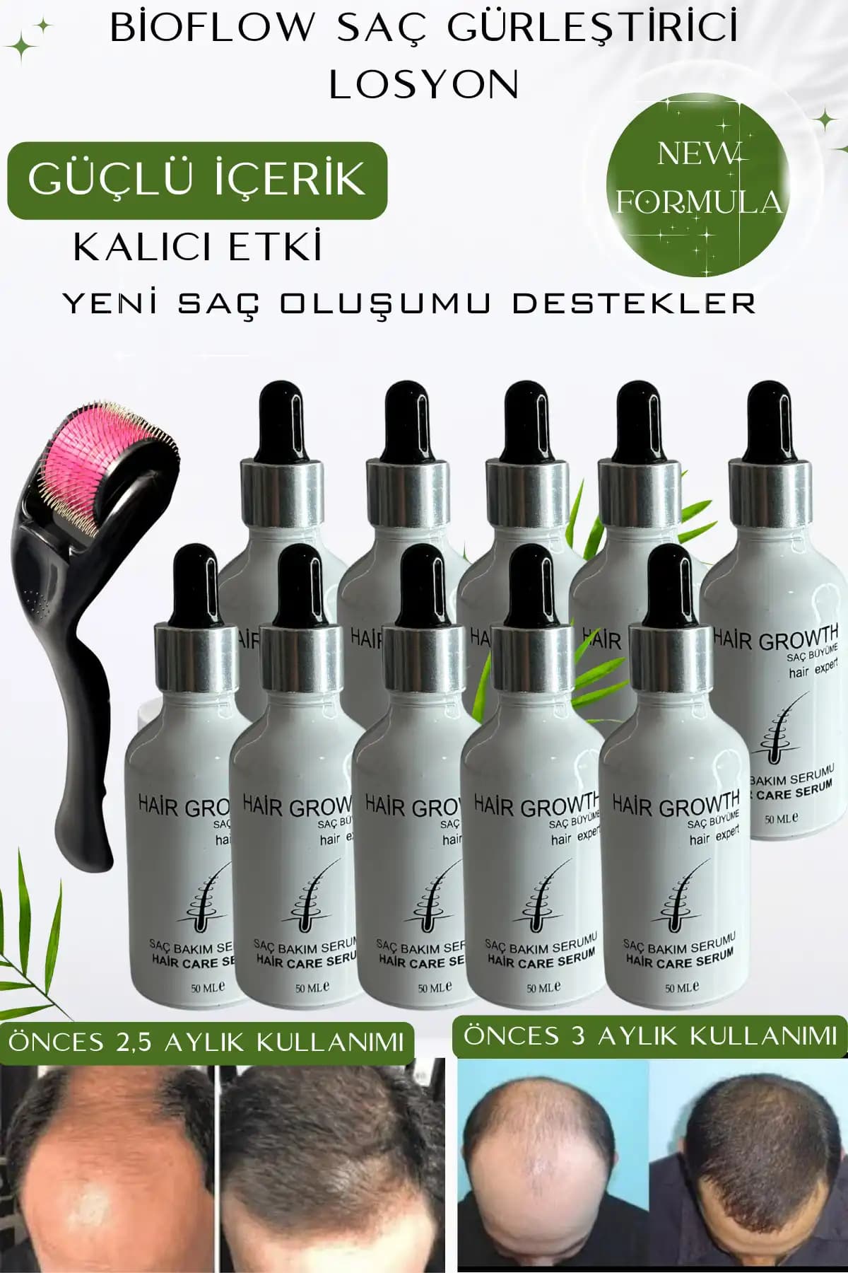 Saç Gürleştirici Ürünler: Kalıcı ve Sağlıklı Saçlara Giden Yol Rehberi