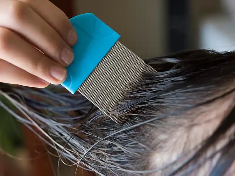 Saçtaki Bitlerden Kurtulma Yöntemleri ve Doğal Çözüm Tavsiyeleri