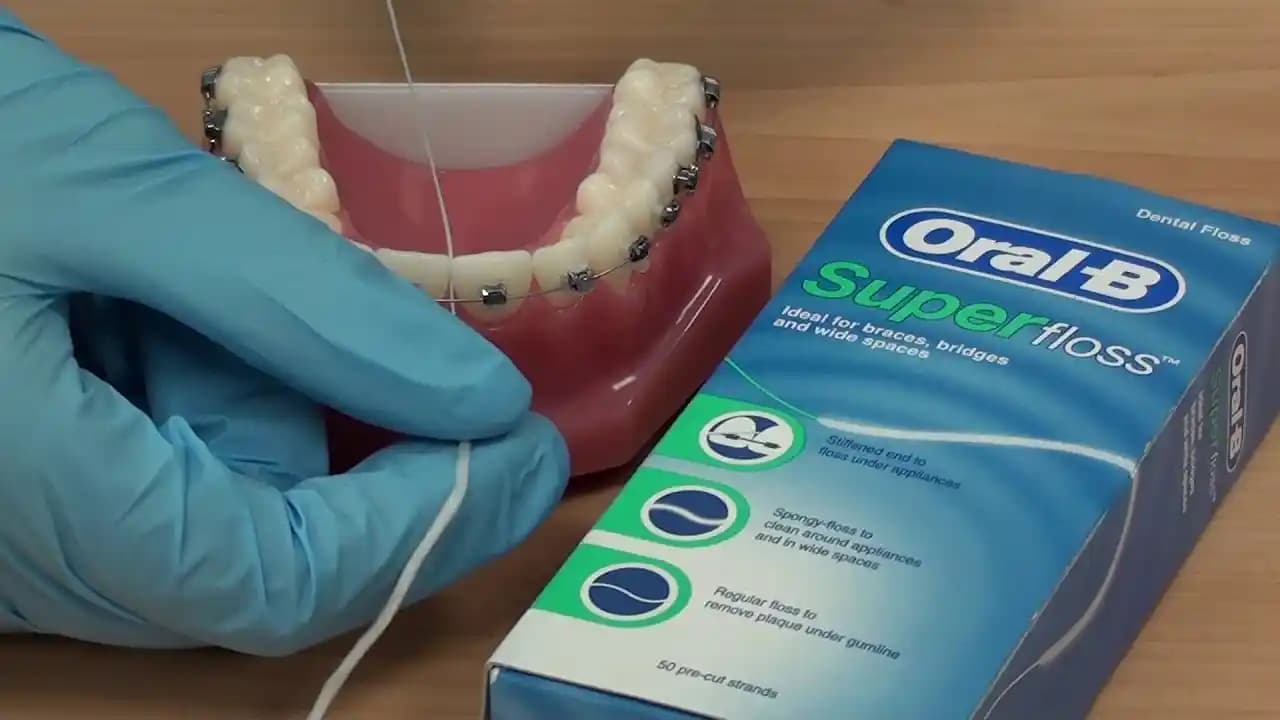 Süper Floss Nedir ve Diş Sağlığında Sağladığı Faydalar Nelerdir