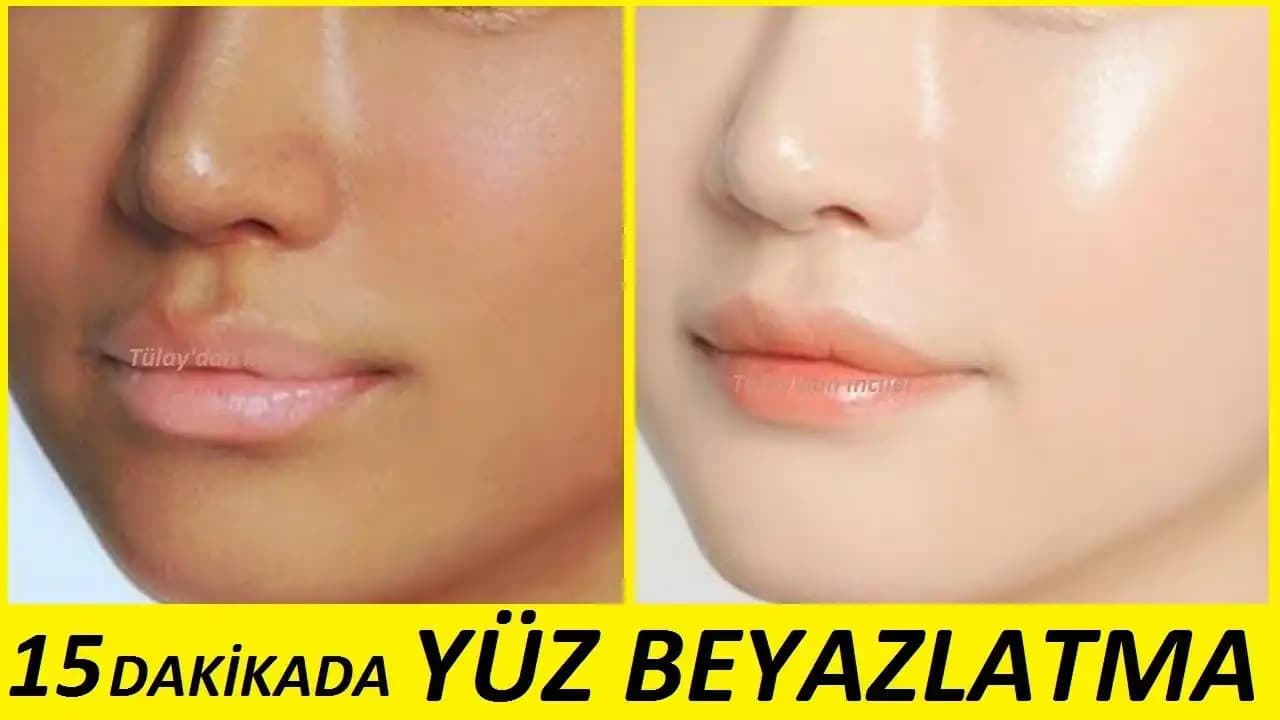 Yüz Beyazlatma Yöntemleri: Güvenilir ve Etkili Cilt Aydınlatma Teknikleri