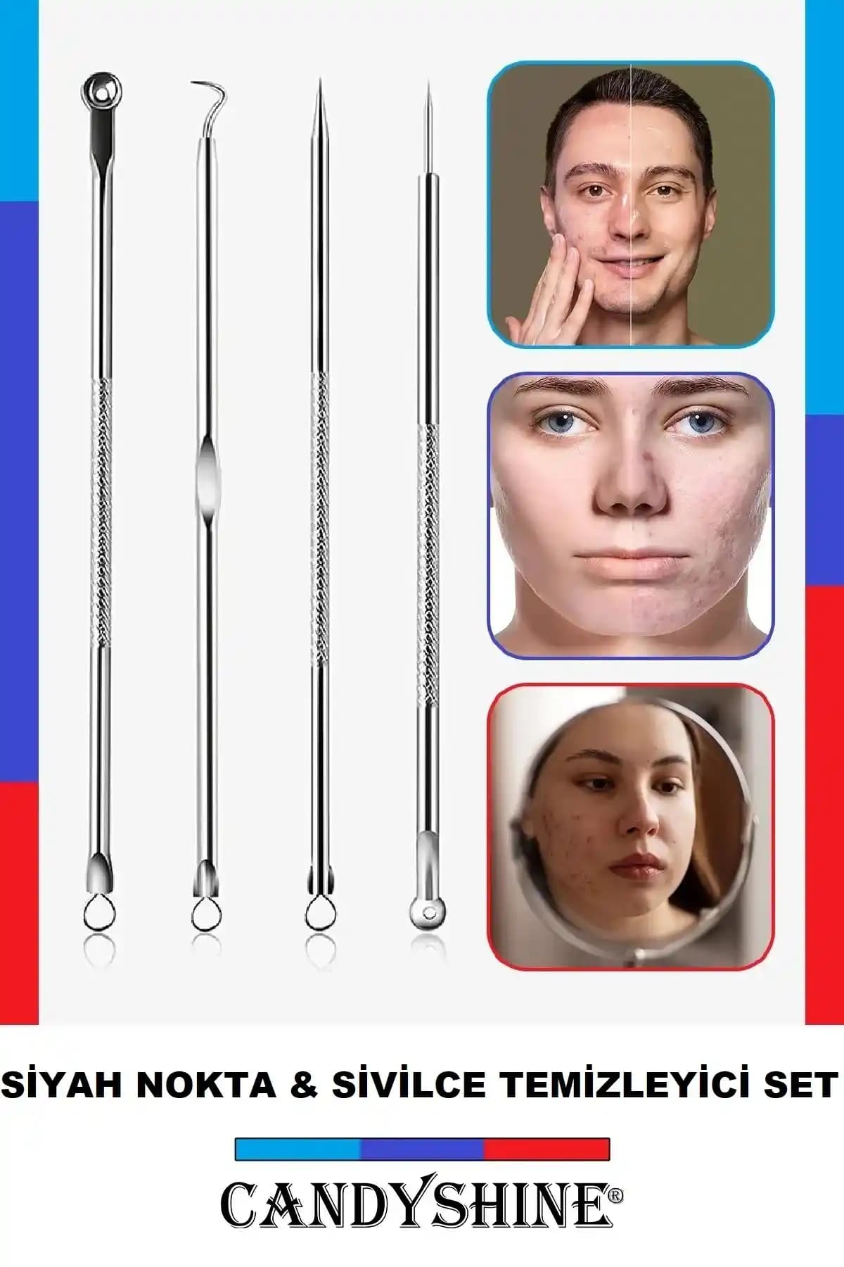 CandyShine Akne ve Siyah Nokta Temizleyici 4'lü Set ile Etkili Cilt Bakımı