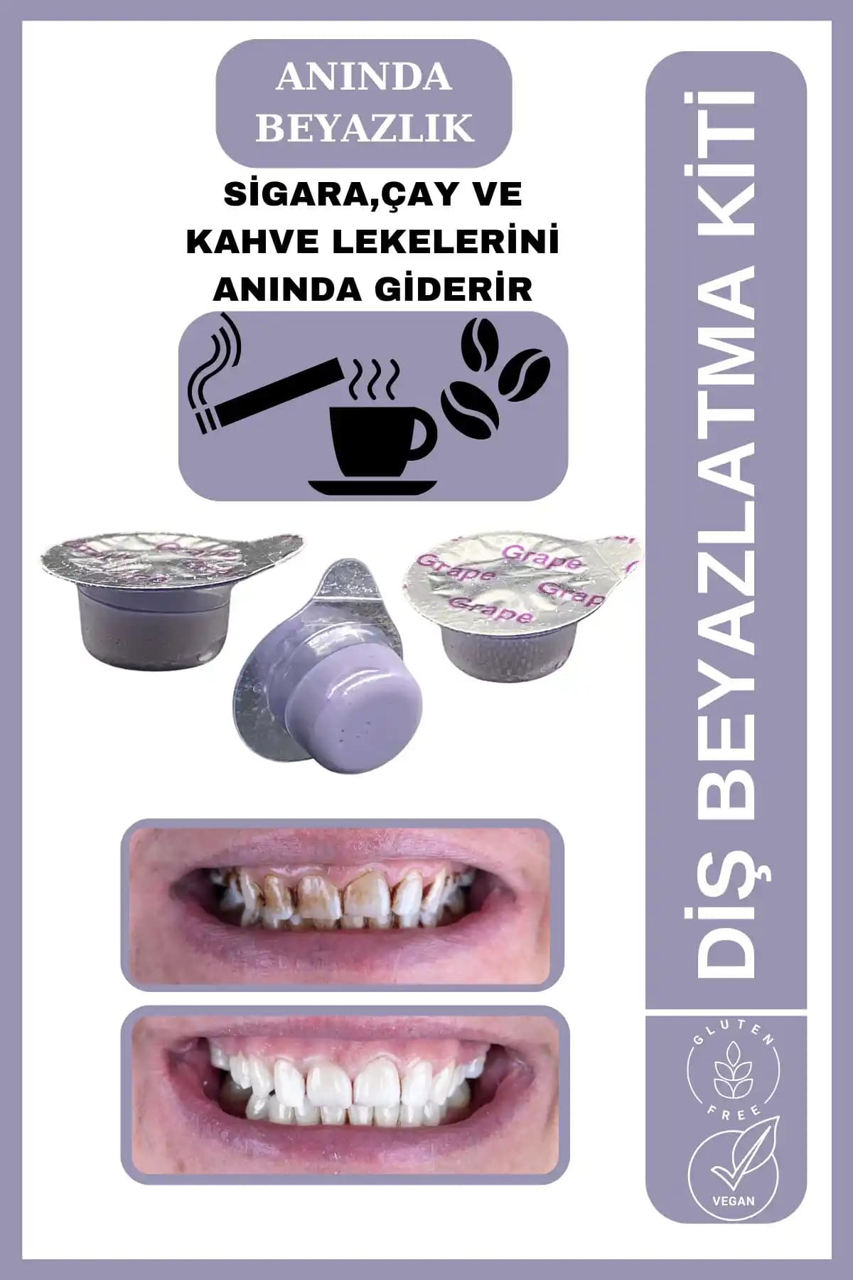 AVANT DENTAL SUPPLY 3 Tüp Diş Beyazlatıcı Seti İncelemesi ve Kullanıcı Yorumları