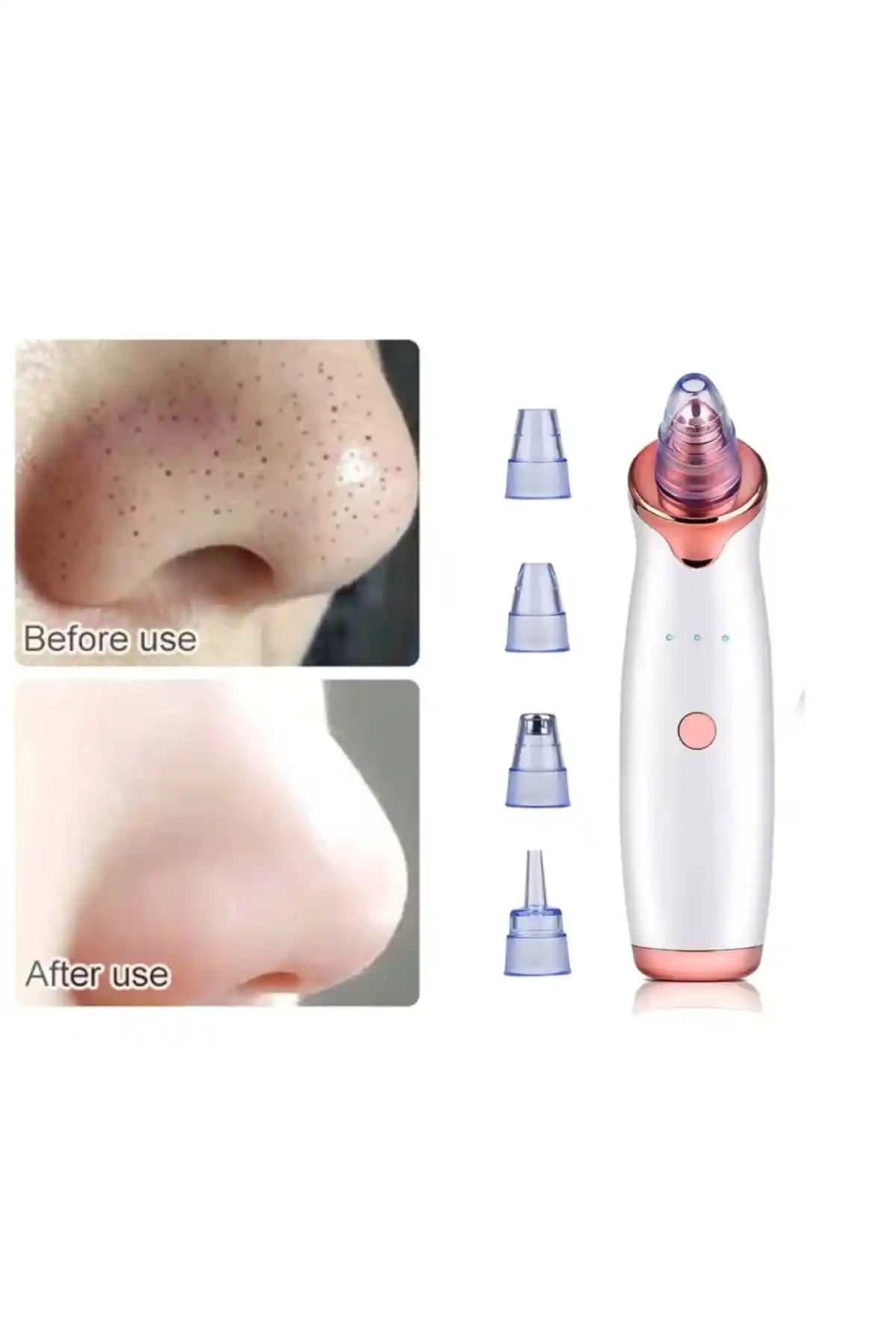 Dermasuction Şarjlı Derma Suction: Siyah Nokta ve Gözenek Temizliğinde Yenilikçi Çözüm