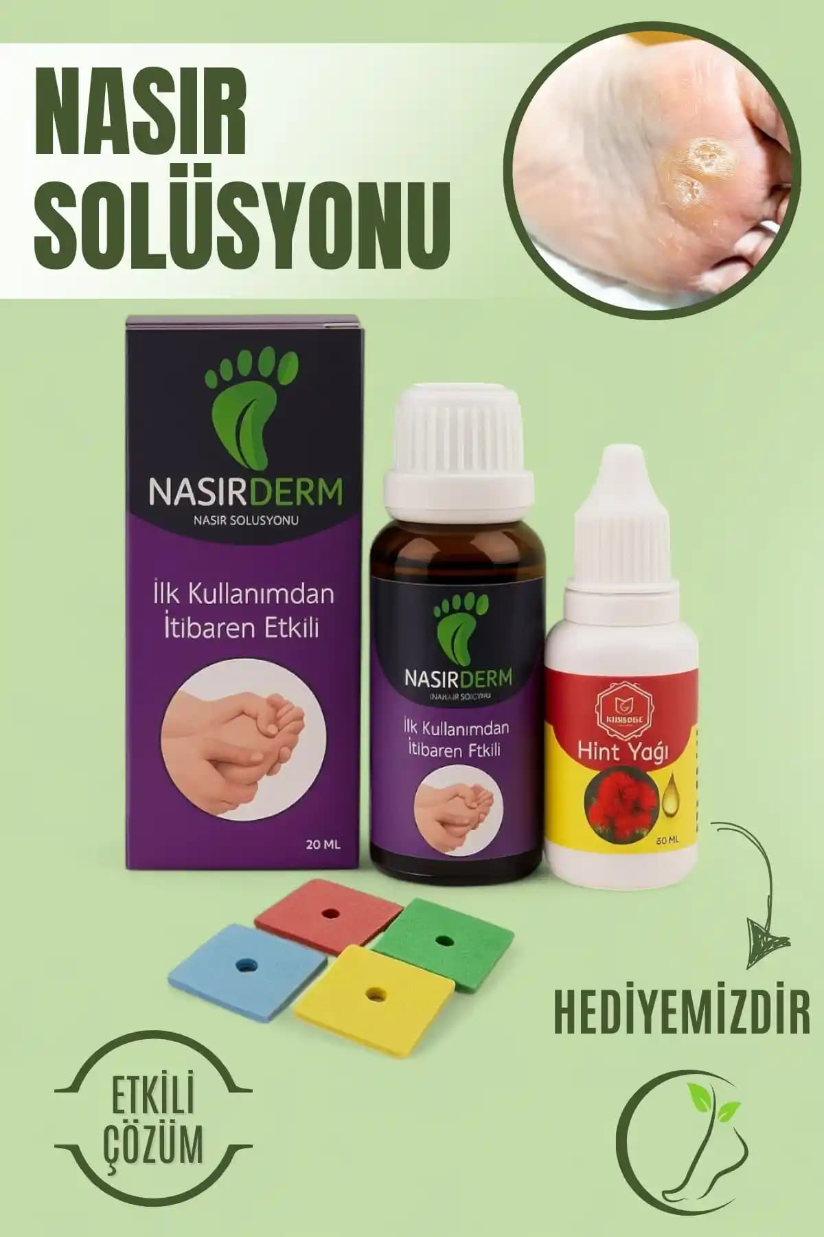 Güzeldost Nasırderm Nasır Sökücü ile El ve Ayak Nasırlarına Etkili Çözüm