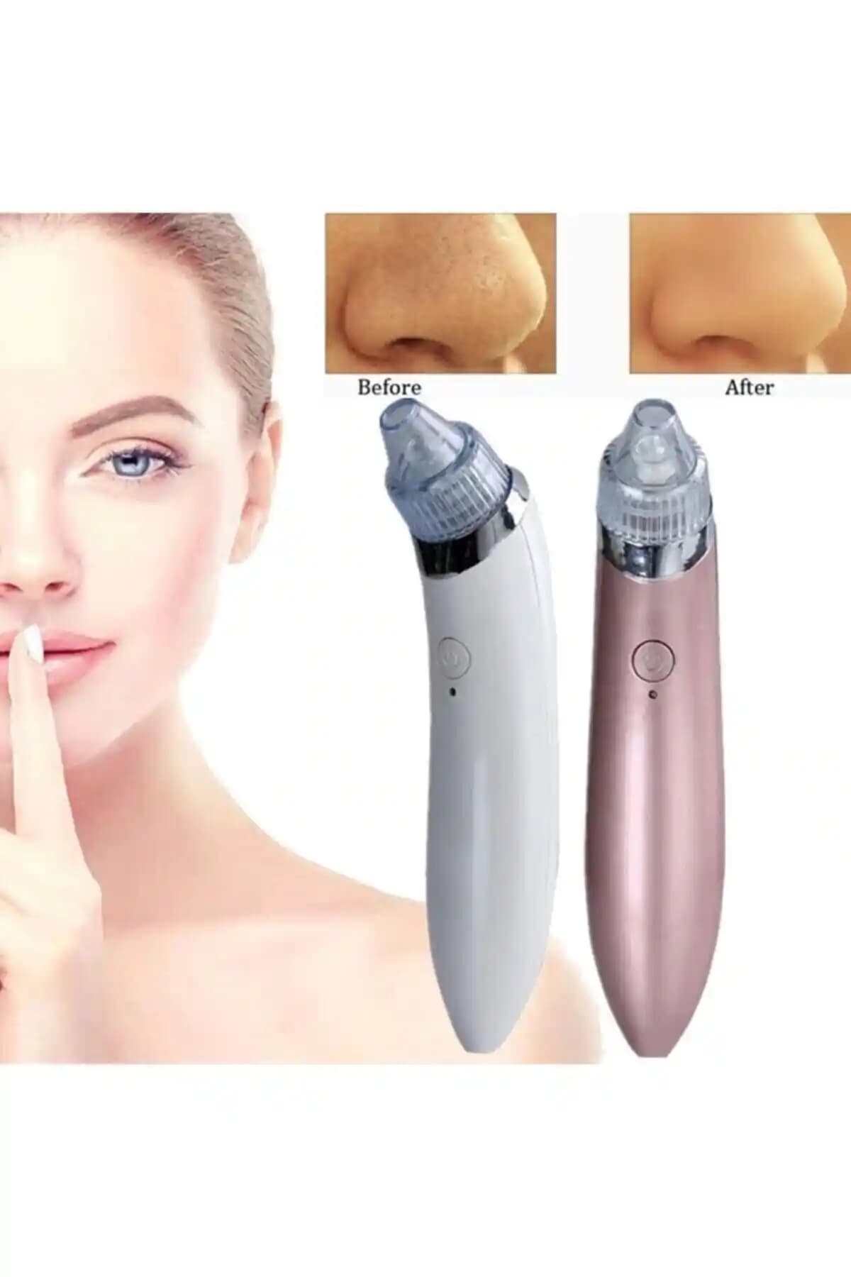 Satfinder Vakumlu Siyah Nokta Akne Temizleme Cihazı İncelemesi ve Kullanıcı Yorumları