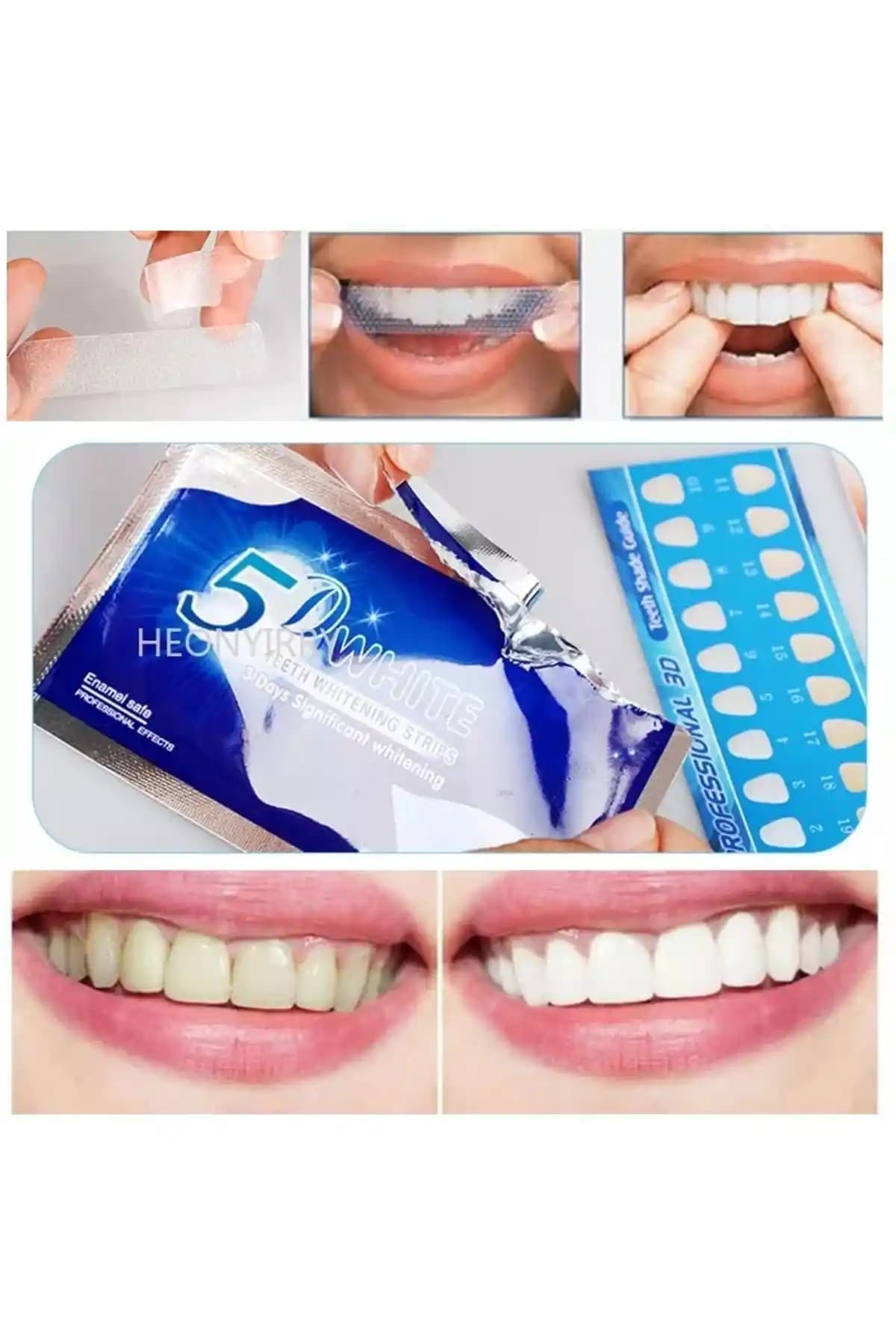 5D WHITE Diş Beyazlatma Bandı: Güvenli ve Pratik Evde Diş Beyazlatma Çözümü